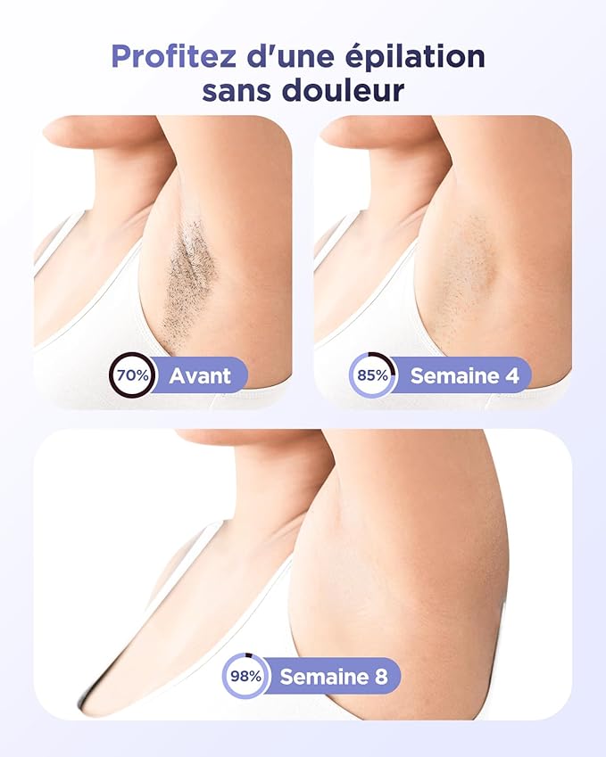 Épilateur à lumière pulsée